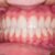 Najczęstsze mity na temat leczenia u dentysty